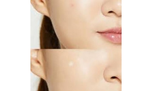 Parches cosrx acne pimple master patch comprar en tienda online michii cosmética coreana en España